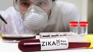Test tube with blood for ZIKA virus test in front of researcher. (Contributed) 